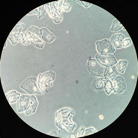 Microscope Transitional Epithelial Cells In Urine Micropedia