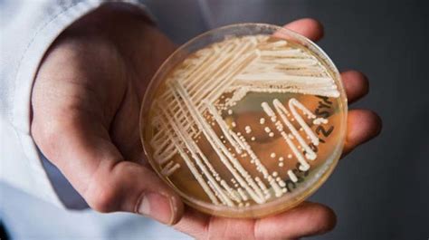 Candida Auris Resistente Hongo Se Propaga Rápidamente En El Mundo La