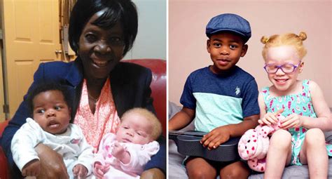 Mother Of Black And White Twins Speaks Of Public Reaction