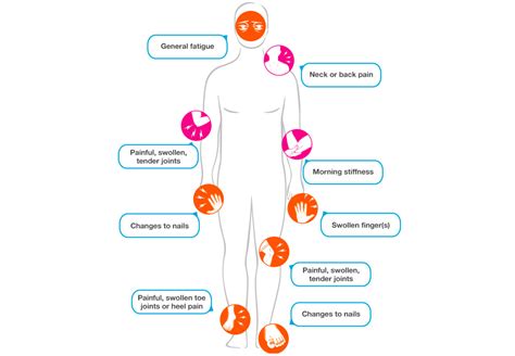 What Causes Psoriatic Arthritis