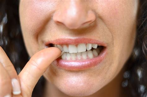 4 Harmful Consequences Of Nail Biting And How To Stop Smilekeepers