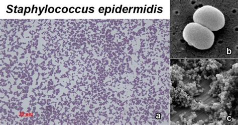 Staphylococcus Epidermidis An Overview Microbe Notes