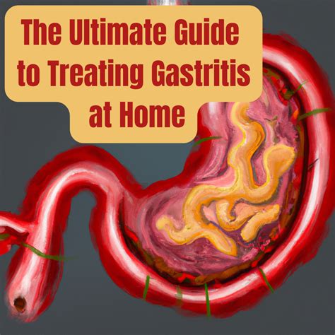The Ultimate Guide To Treating Gastritis At Home Medicovibe