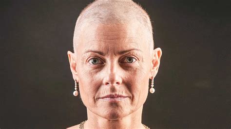 Breast Cancer Treatment And Hair Loss Prevention