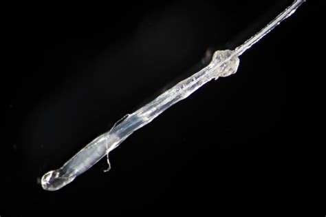 The proximal tip of the follicle is invaginated to form a cap over the dermal papilla, a condensation the irregular black color is the matrix, where transit amplifying cells migrate upward to differentiate into the parts of the hair. Hair Root Follicle Or Bulb By Microscope Human Gray Hair ...