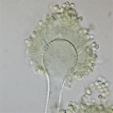 Aspergillus flavus has a worldwide distribution and normally occurs as a saprophyte in soil and on many kinds of decaying organic matter, however, it is also a recognised pathogen of humans and. Aspergillus flavus - Wiktionary
