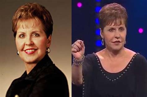 Joyce Meyer Plastic Surgery Photo Before And After CELEB SURGERY COM