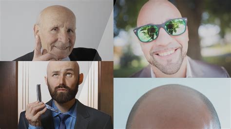 Different Types Of Head Shapes Different Types Of Bald Heads Youtube