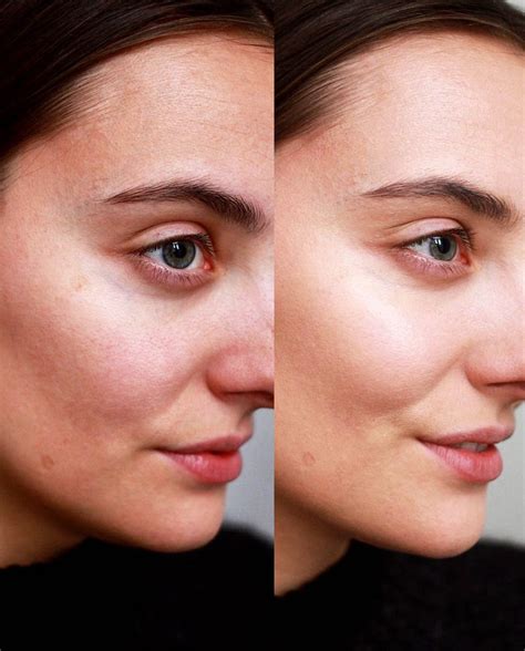 Even better clinical™ radical dark spot corrector + interrupter, our most powerful brightening serum, helps correct and disrupt future discolouration. Even Better Glow foundation: before/after - polienne
