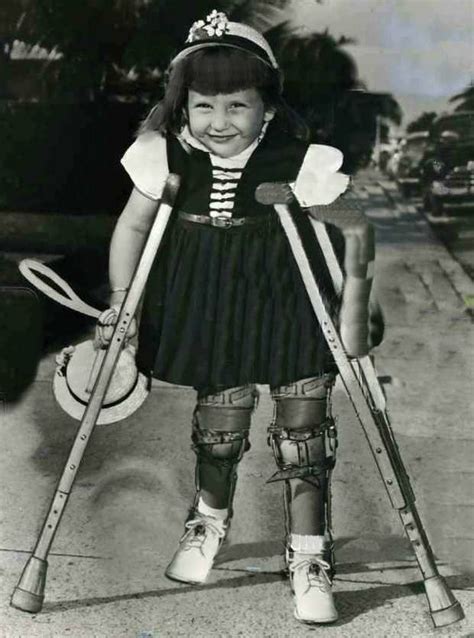 Pin By Dianne Dych On Polio Leg Braces Polio Black Thigh High