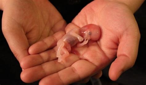 Stunning Photo Of Noah Miscarried At Weeks Shows Life In The Womb