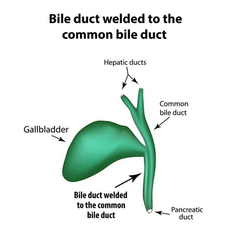 Liver Bile Ducts Blocked