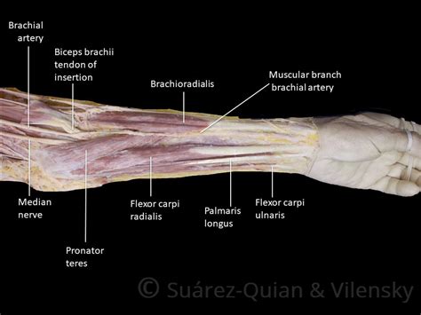 The antibrachial or forearm muscles may be divided into a volar and a dorsal group. Muscles of the Anterior Forearm - Flexion - Pronation ...