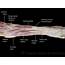 Muscles Of The Anterior Forearm  Flexion Pronation TeachMeAnatomy