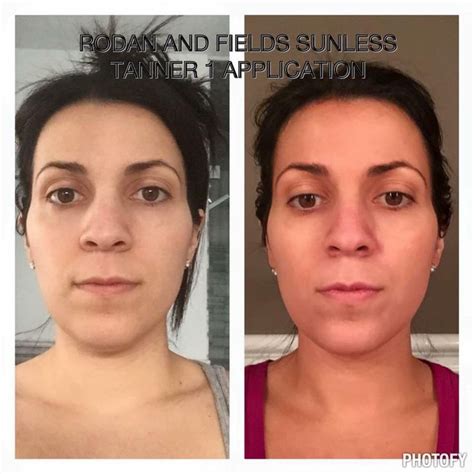 Rodan And Fields Sunless Tanner Before And After Rodan And Fields
