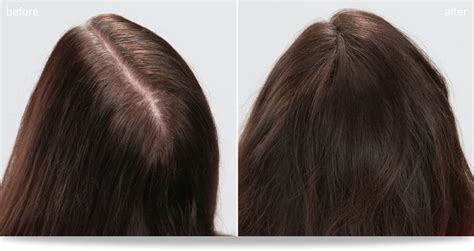 biotin hair growth results before and after home design ideas