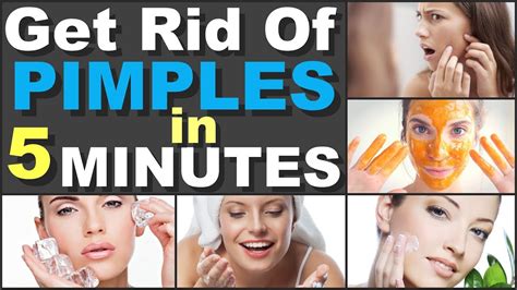 how to get rid of pimples in 5 minutes fast with home remedies for pimple youtube