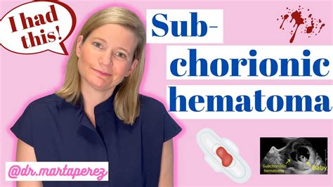 Obgyn Explains Subchorionic Hematoma My Story First Trimester