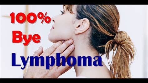 How To Cure Lymphoma Symptoms And Treatment Of Lymphoma Youtube