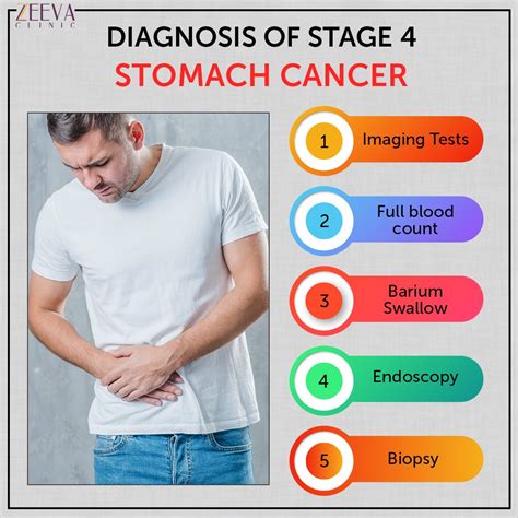 Stomach Cancer Symptoms Stages