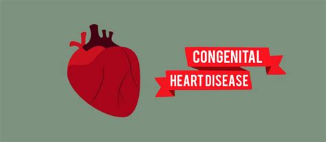 Congenital Heart Disease Explained German Heart Centre