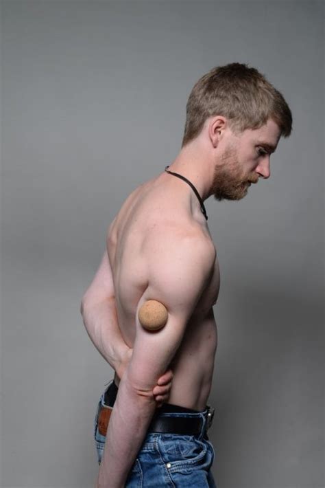 Triceps brachii muscle pain & trigger points