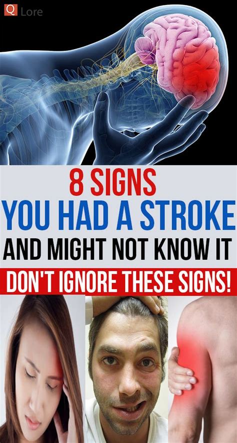 8 Signs You Had A Stroke And Might Not Know It Dont Ignore These Signs Wellness True