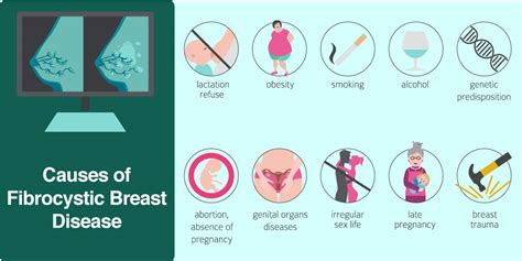 Fibrocystic Breast Disease Pictures