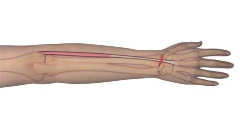 Each tunnel is lined internally by a synovial sheath and separated from one another by a fibrous septa. Muscle Test and Tendon Exam: Extensor Carpi Radialis Brevis (ECRB) | Hand Surgery Source