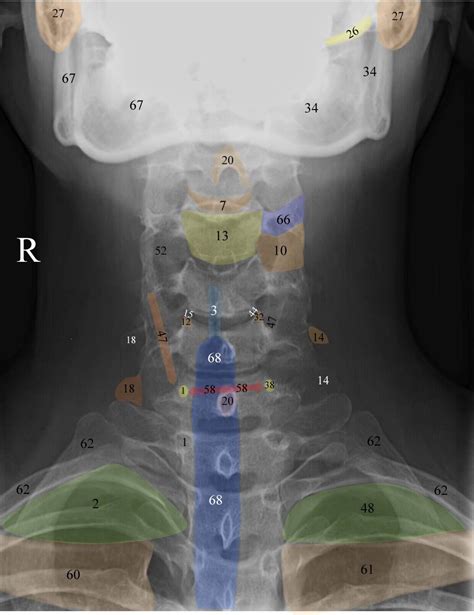 Normal Radiographic Anatomy Of The Cervical Spine Tıp Fakültesi Tıp