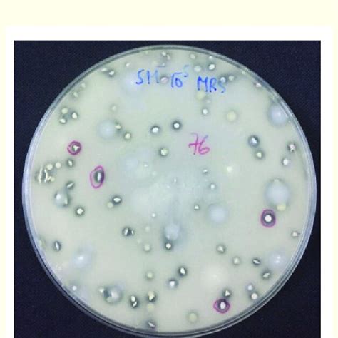 Plate Showing Clearing Around Colonies Of Acid Forming Bacteria On Mrs Download Scientific