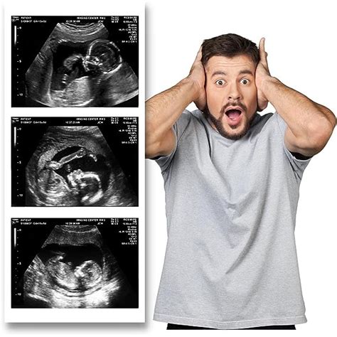laugh out loud funny reactions to the fake 3d sonogram prank magazines pro
