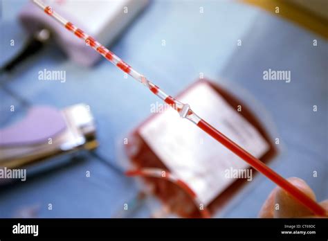 Cord Blood Hi Res Stock Photography And Images Alamy