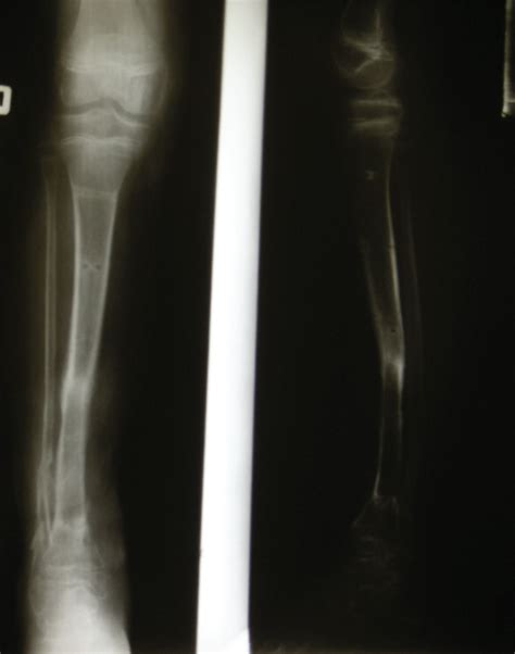 Clinmed International Library Segmental Bone Muscle And Skin Cross