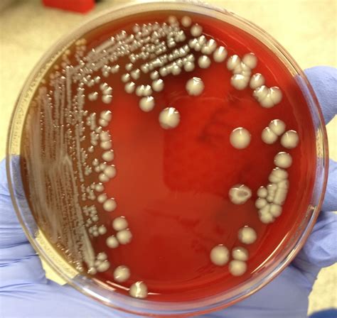 Streptococcus Pneumoniae On Blood Agar Sudded