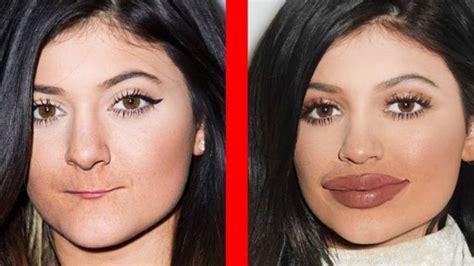 These Celebrities Admitted To Having Plastic Surgeries Demotix