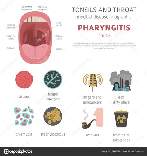 Pharyngitis Acute Symptoms The Request Could Not Be Satisfied