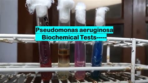 Biochemical Tests Of Pseudomonas Aeruginosa Demonstration Youtube