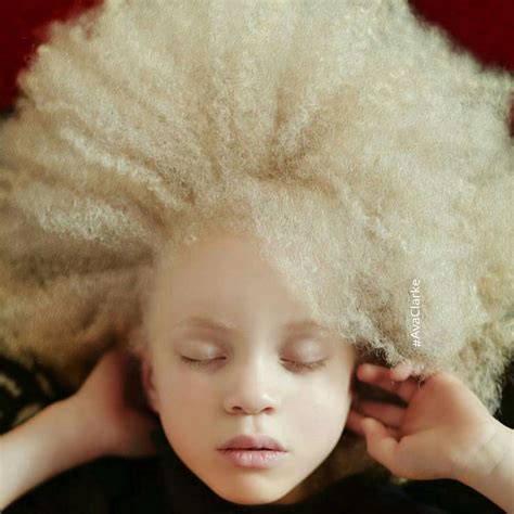 Unique Beauty Of Albino People Demilked