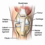 Images of Back Of Knee Tendon Pain Treatment