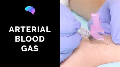 How To Take An Arterial Blood Gas Abg Osce Guide Ukmla Cpsa Youtube