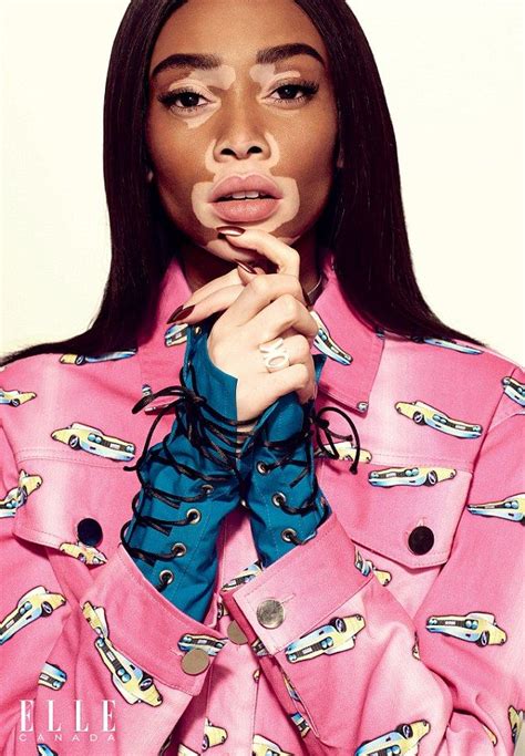 Winnie Harlow Flashes Her Bra In Edgy Shoot For Fashion Magazine