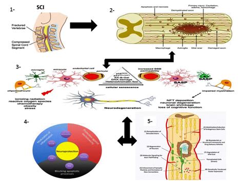 Ijms Free Full Text Spinal Cord Injury Pathophysiology