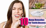 Toothache Abscess Home Remedies