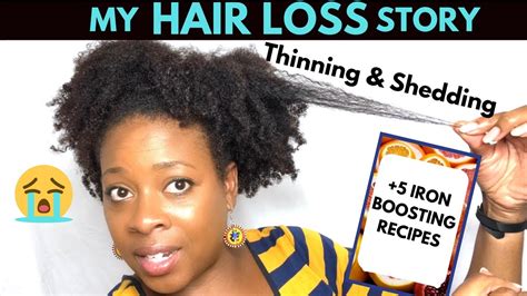 Moreover, feelings of tiredness, irritation, and weakness are common. My Hair Loss Story | Iron deficiency Anemia & 5 Iron ...