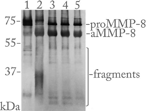 The Activation Of Human 75 Kda Prommp 8 By Tremonema Denticola
