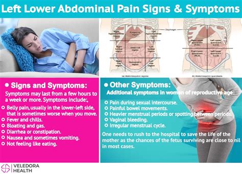Abdominal Pain The Left Lower Quadrant Pain Explained