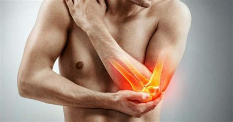 Elbow Dislocations Oss Health