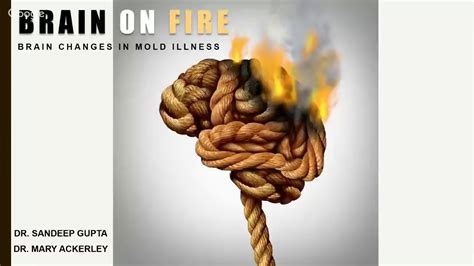 Brain On Fire Webinar Brain Changes In Mold Illness With Dr Mary