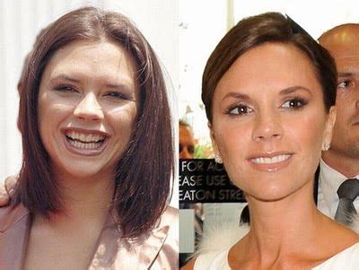 Welcome To Funnydust Famous Smiles Before And After Photos Celebrity Teeth Celebrity